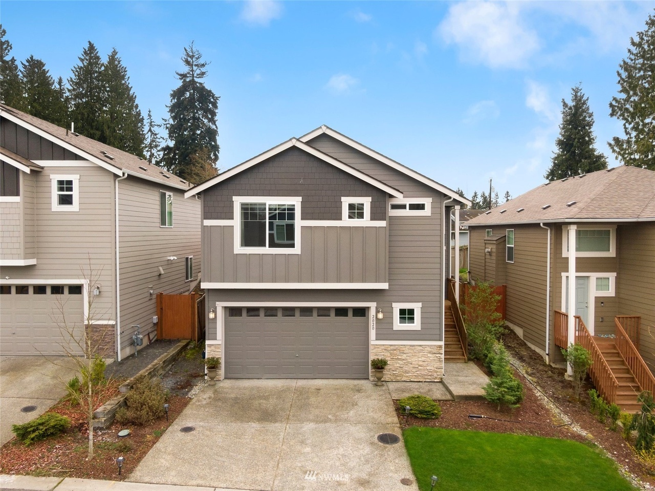Archived property photo: 2020 148th Pl SW, Lynnwood, WA
